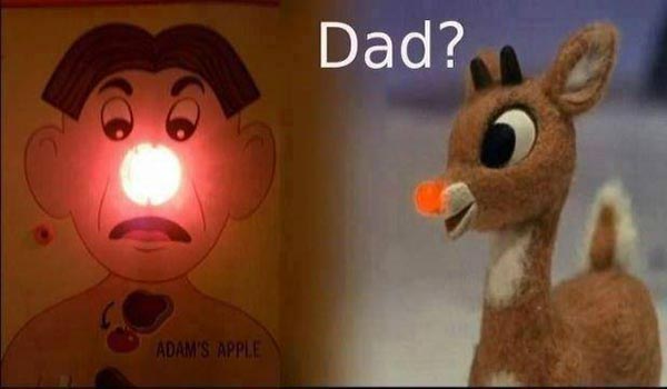 Rudolph to Operation Game: "Dad?"