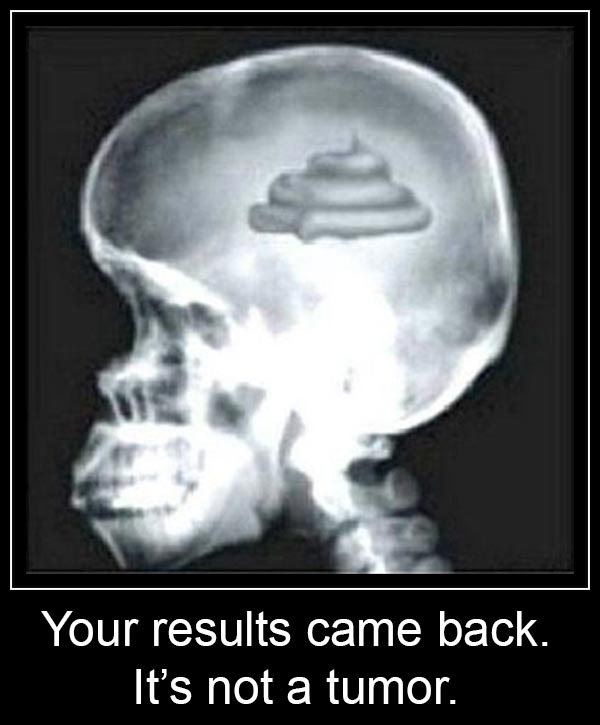 Your results came back... it's not a tumor.